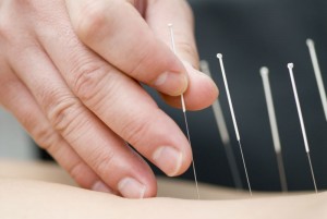 South Florida Acupuncture Clinics